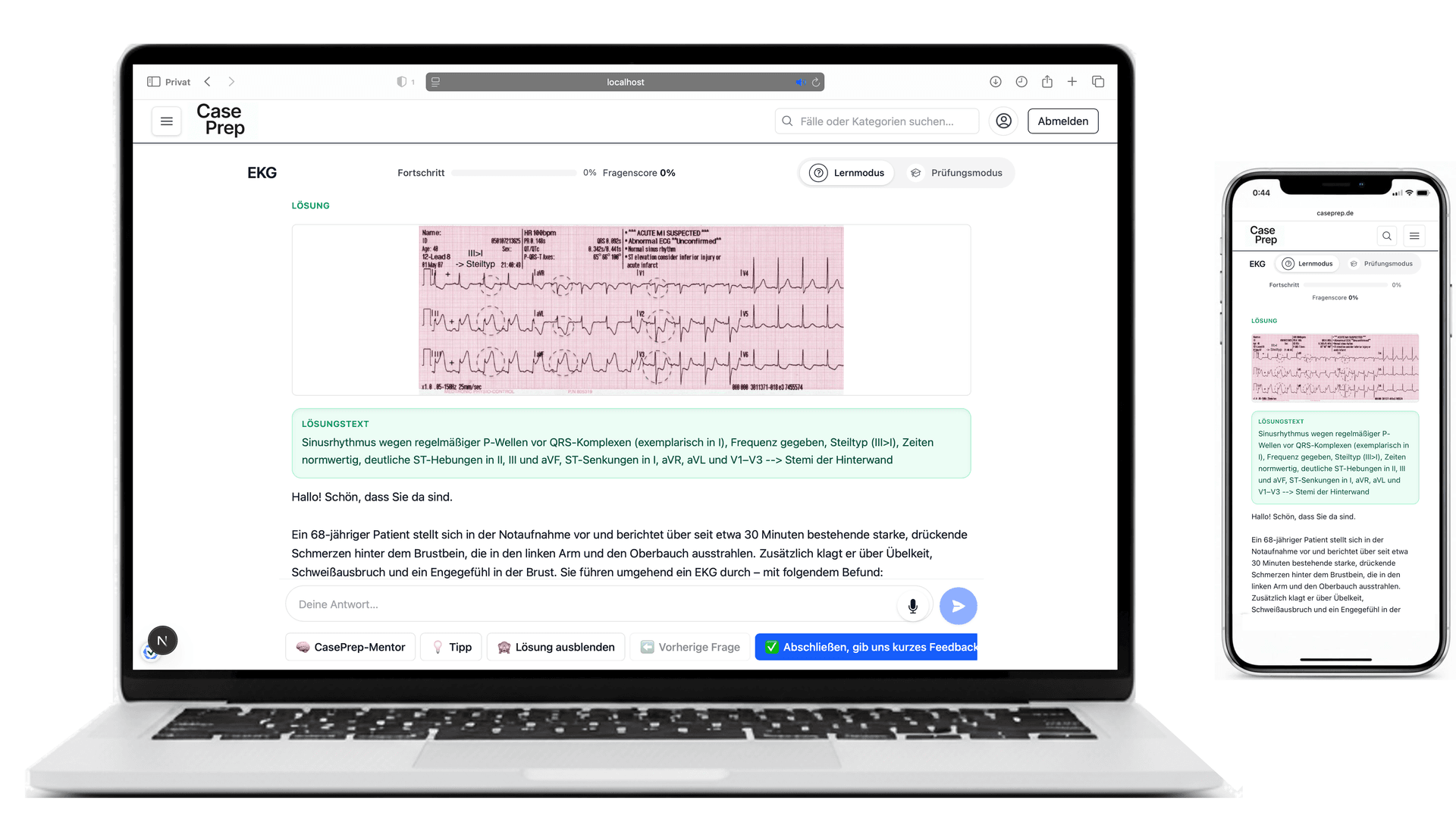 Detailansicht einer EKG-Befundung mit dem interaktiven CasePrep Raster