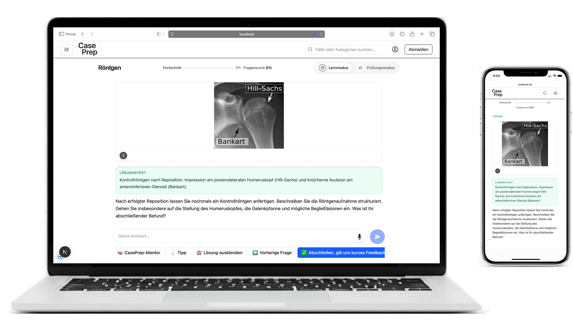 Fallbeispiel einer Skelettröntgen-Befundung mit dem CasePrep Analyse-Tool