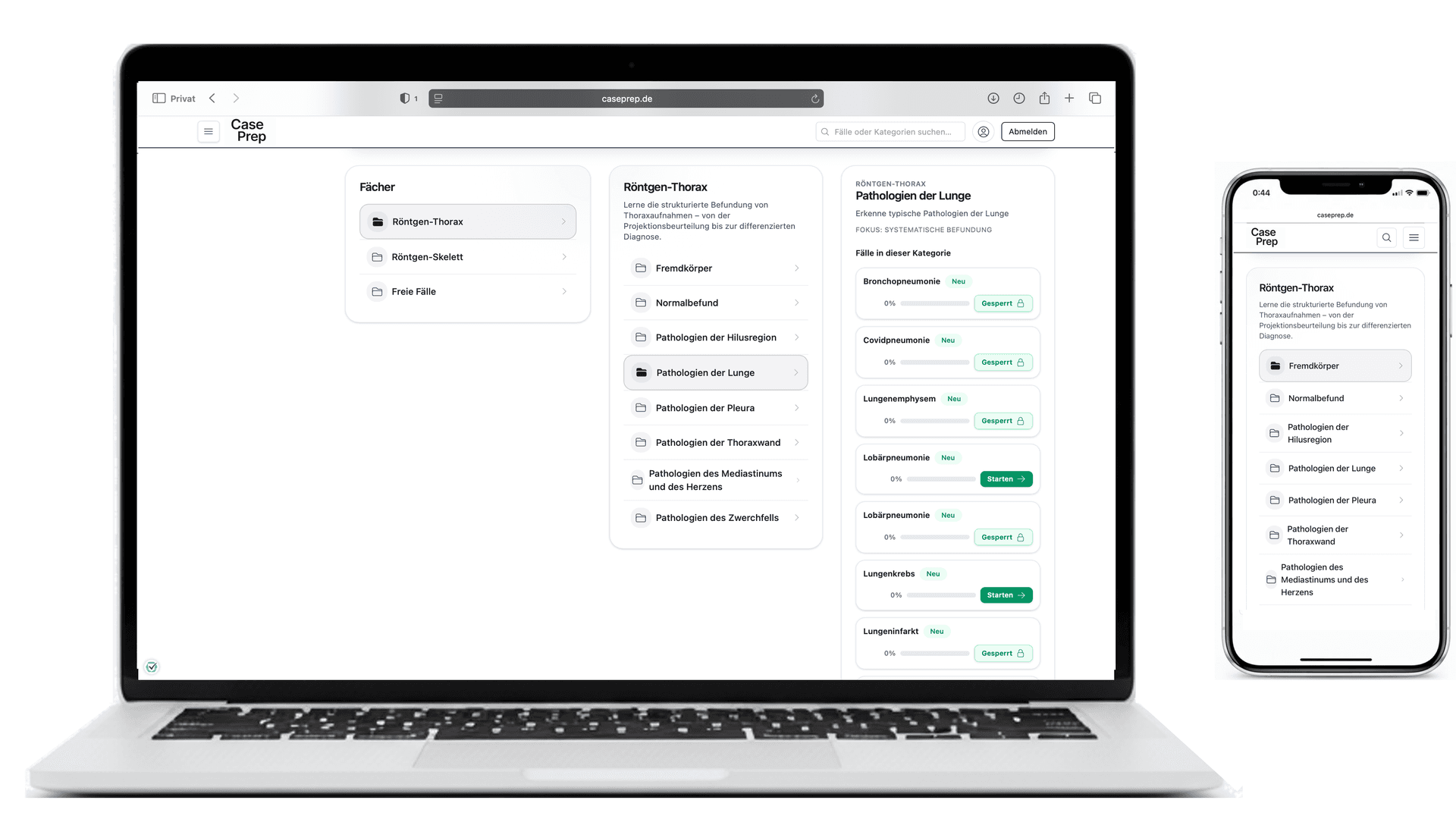 Übersicht der radiologischen Fallkategorien bei CasePrep