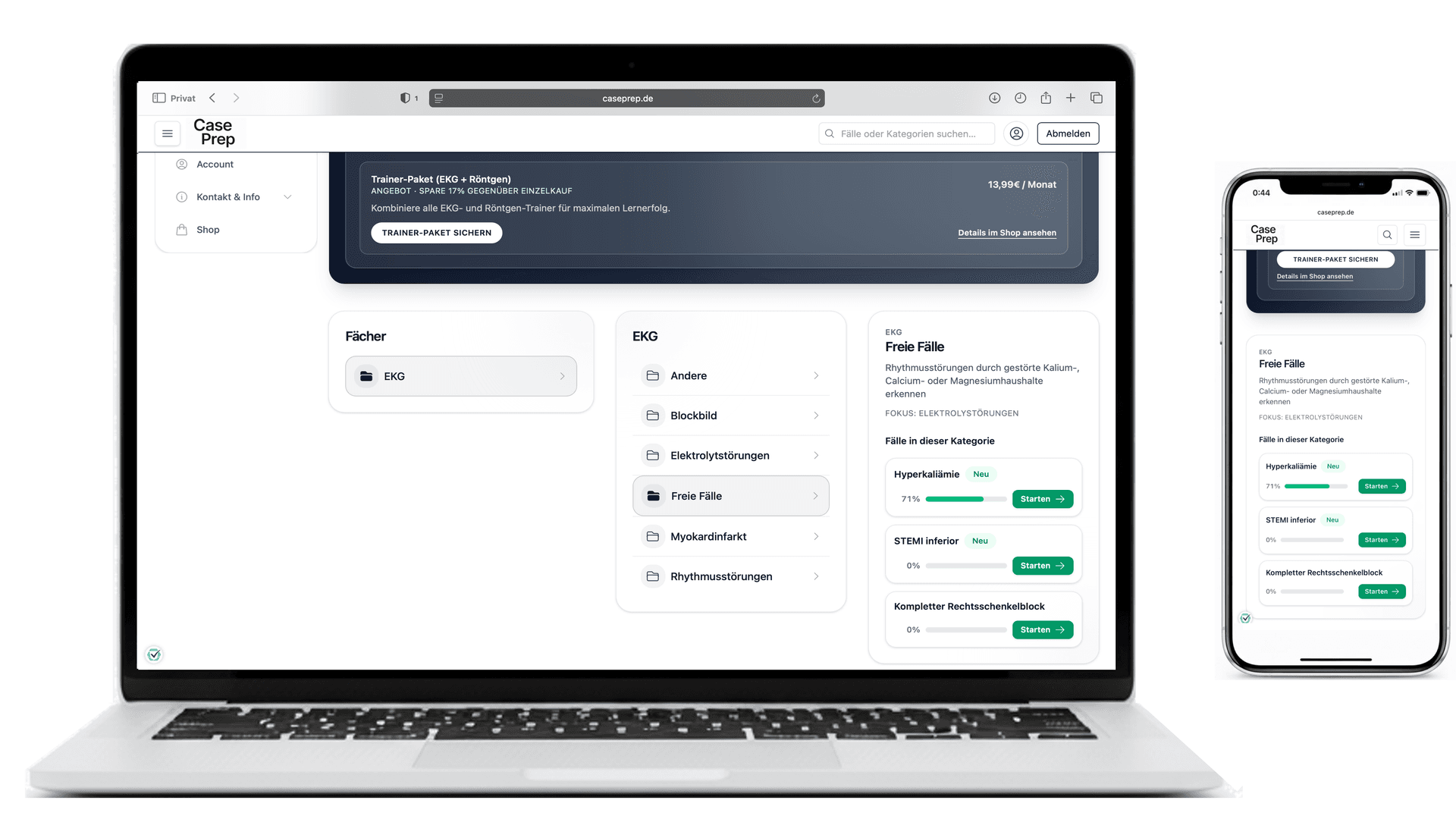 Visualisierung der EKG-Fallkategorien im CasePrep Trainer