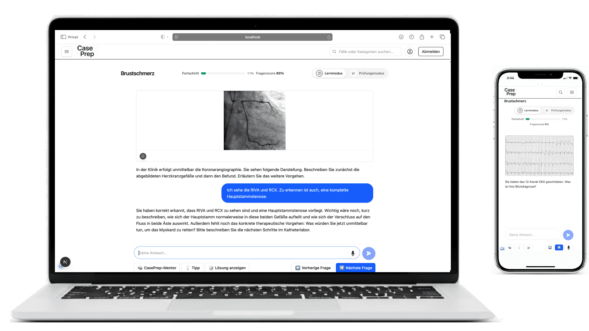 Detailgrafik für zusätzliche Fallszenarien